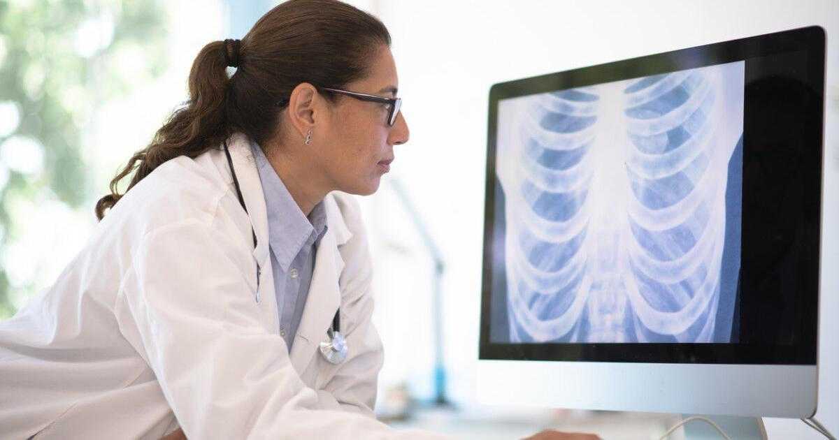 'I'm a Pulmonologist, and This Is the Daily Habit I Swear By for Lung Health' 'I'm a Pulmonologist, and This Is the Daily Habit I Swear By for Lung Health'