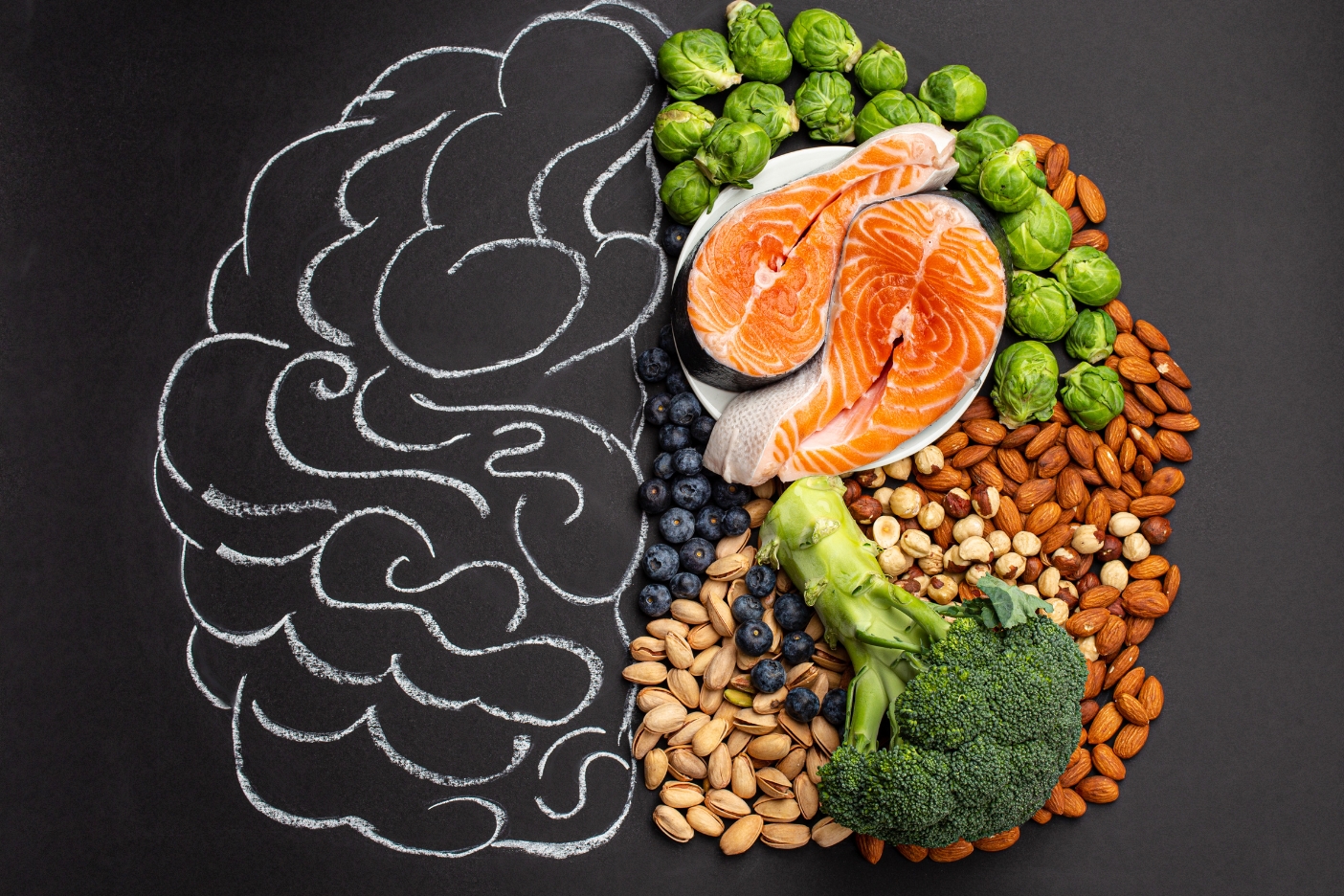 Can the MIND Diet Prevent Cognitive Decline and Dementia? Can the MIND Diet Prevent Cognitive Decline and Dementia?