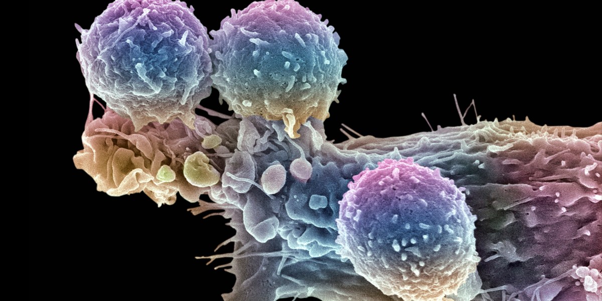 The effort to make a breakthrough cancer therapy cheaper The effort to make a breakthrough cancer therapy cheaper