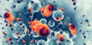Tumor-Infiltrating Lymphocyte Therapy Advances Into Melanoma Tumor-Infiltrating Lymphocyte Therapy Advances Into Melanoma