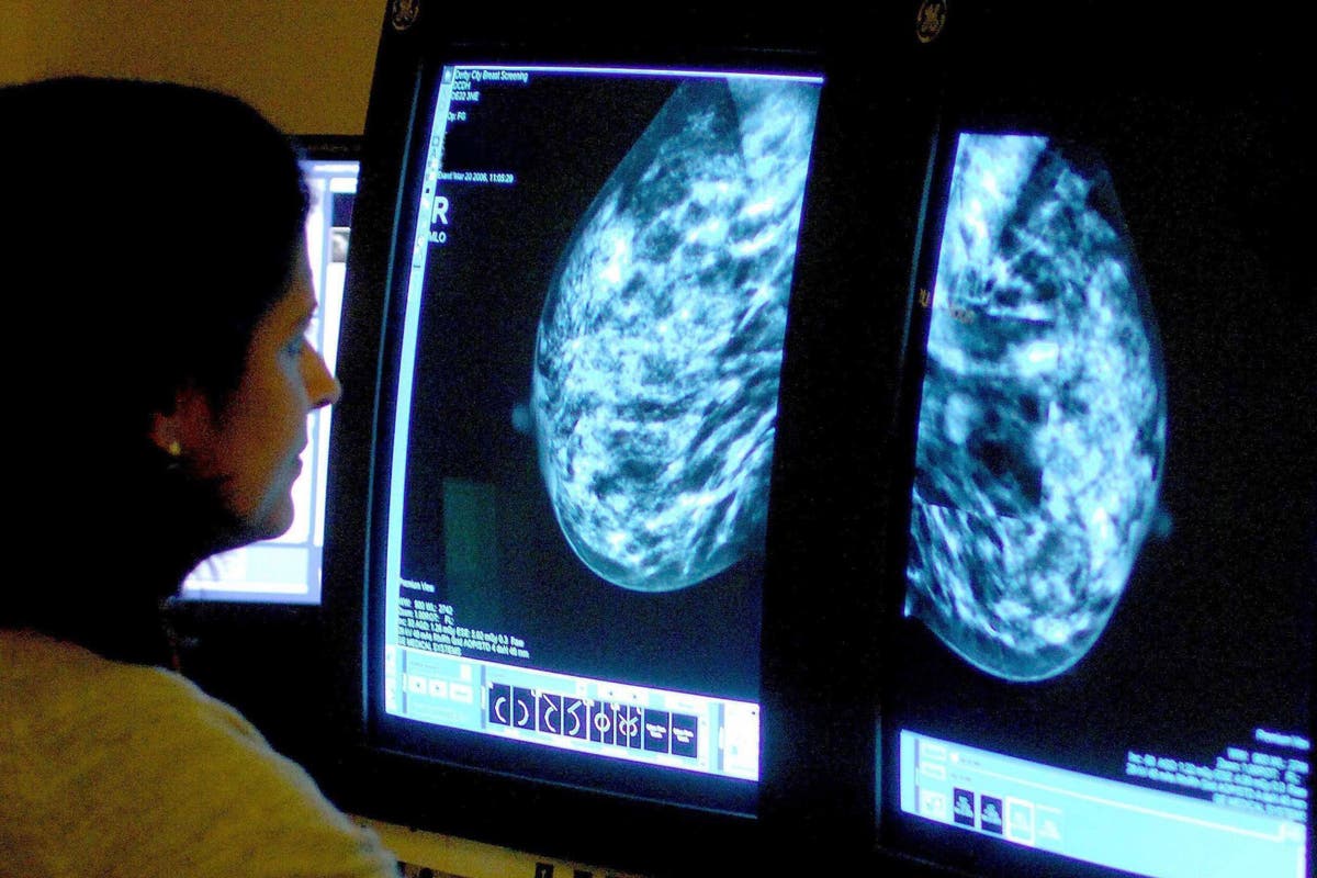 ‘Pioneering’ breakthrough paves way for more effective breast cancer treatment ‘Pioneering’ breakthrough paves way for more effective breast cancer treatment