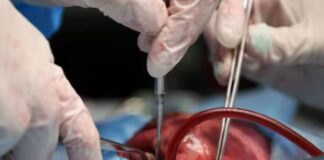 US Fitness Influencer Undergoes Surgery After Tool Falls Inside His Heart US Fitness Influencer Undergoes Surgery After Tool Falls Inside His Heart