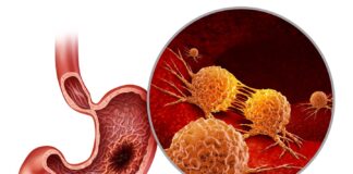 Accord BioPharma’s HERCESSI gets FDA approval Accord BioPharma's HERCESSI gets FDA approval