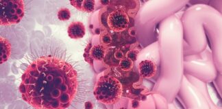 ESMO: Innovent links cytokine fusion protein to responses in colorectal cancer ESMO: Innovent links cytokine fusion protein to responses in colorectal cancer