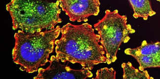 Highlights from ESMO 2024: Key Oncology Advances from Major Pharmaceutical Companies Highlights from ESMO 2024: Key Oncology Advances from Major Pharmaceutical Companies