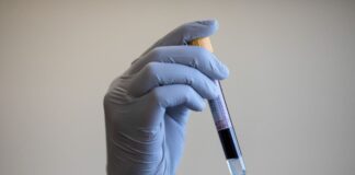 Prostate cancer breakthrough as scientists pinpoint protein for treatment Prostate cancer breakthrough as scientists pinpoint protein for treatment