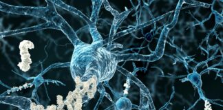 Breakthrough Discovery: Freezing Alzheimer’s Progress by Pausing Amyloid Fibrils Breakthrough Discovery: Freezing Alzheimer’s Progress by Pausing Amyloid Fibrils