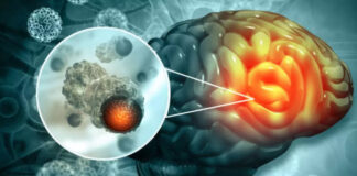 Cancer Treatment Drug: A Breakthrough Cancer Treatment Could Cure The Deadly Disease As It Makes Tumours Disappear author-479257930