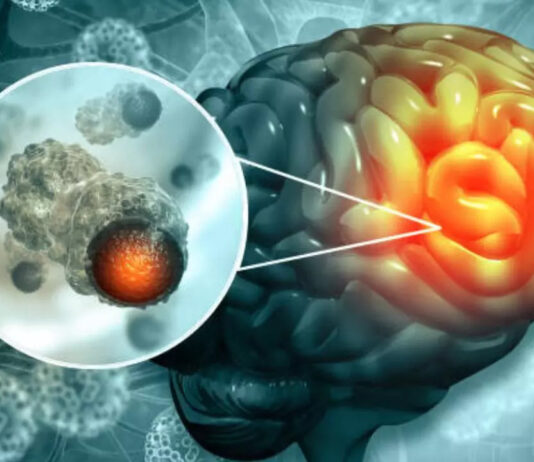 Cancer Treatment Drug: A Breakthrough Cancer Treatment Could Cure The Deadly Disease As It Makes Tumours Disappear author-479257930