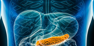 Combination Therapy May Improve Treatment Response in Pancreatic Cancer Combination Therapy May Improve Treatment Response in Pancreatic Cancer