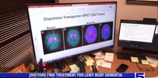 Doctors find treatment for Lewy body dementia Doctors find treatment for Lewy body dementia
