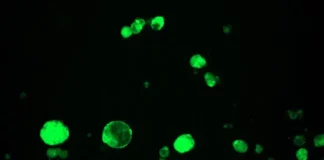 HER2 positive treatment resistant breast cancer treatment breakthrough HER2 Breast Cancer