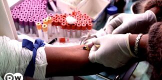 Namibia’s success story – DW – 10/17/2024 Namibia's success story – DW – 10/17/2024