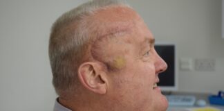 New Treatment Shrinks Man’s Aggressive Brain Tumour By Half In Breakthrough Trial New Treatment Shrinks Man's Aggressive Brain Tumour By Half In Breakthrough Trial