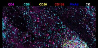 Novel Immune Structures in Liver Tumors Point to Cancer Treatment Breakthrough Novel Immune Structures in Liver Tumors Point to Cancer Treatment Breakthrough