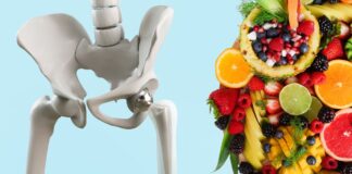 Nutrition and social support important for hip fracture recovery Hip fracture