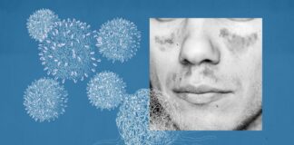 A ‘Crazy’ Idea for Treating Autoimmune Diseases Might Actually Work A ‘Crazy’ Idea for Treating Autoimmune Diseases Might Actually Work