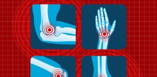 5 Common Arthritis Myths, Debunked by Science 5 Common Arthritis Myths, Debunked by Science