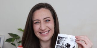 IVF miracle powered by AI tech in major breakthrough hailed ‘game-changing’ | Science | News IVF miracle powered by AI tech in major breakthrough hailed 'game-changing' | Science | News