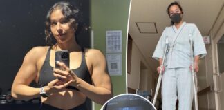 I fractured my hip with a butt-boosting exercise, don’t make my mistake I fractured my hip with a butt-boosting exercise, don't make my mistake