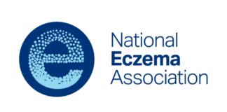 Stress and Eczema | Eczema and Mental Health Stress and Eczema | Eczema and Mental Health