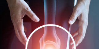Vascular Institute provides breakthrough knee pain treatment Vascular Institute provides breakthrough knee pain treatment