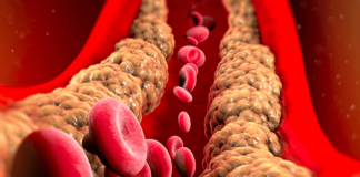 ‘This is revolutionary!’: Breakthrough cholesterol treatment can cut levels by 69% after one dose ‘This is revolutionary!’: Breakthrough cholesterol treatment can cut levels by 69% after one dose