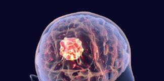 Brain Cancer Treatment Market Set to Surge: Breakthrough Brain Cancer Treatment Market