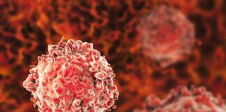 Breakthrough drug therapy offers new hope for leukemia patients Breakthrough drug therapy offers new hope for leukemia patients