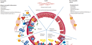 Breakthroughs in asthma therapy Mechanisms and characteristic pathological features of asthma immunopathology