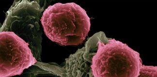 CAR T Breakthrough Therapy Doubles Survival Time for Deadly Stomach Cancer CAR T Breakthrough Therapy Doubles Survival Time for Deadly Stomach Cancer