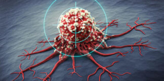 Israeli researchers help achieve breakthrough in myeloma treatment Israeli researchers help achieve breakthrough in myeloma treatment