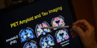 Thousands of NHS patients denied breakthrough Alzheimer’s drugs Thousands of NHS patients denied breakthrough Alzheimer’s drugs