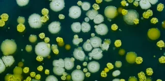 Frontiers | Diagnostic challenges and treatment breakthroughs in Malassezia restricta-induced meningoencephalitis: a real-world analysis of early mNGS applications Frontiers | Diagnostic challenges and treatment breakthroughs in Malassezia restricta-induced meningoencephalitis: a real-world analysis of early mNGS applications