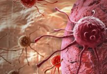 NCCN conference highlights advances in global cancer care strategies Heart-healthy habits can improve overall physical and psychological well-being