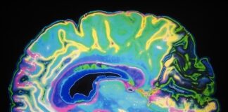 Ibogaine treatment shows major breakthrough for veterans with brain injuries Ibogaine treatment shows major breakthrough for veterans with brain injuries