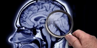 Alzheimer’s breakthrough as scientists discover ’cause and treatment’ – Health – News Alzheimer’s breakthrough as scientists discover 'cause and treatment' - Health - News