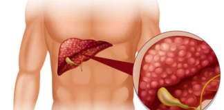 Breakthrough In Liver Cirrhosis Treatment: Indian Scientists Develop New Approach | Health News Breakthrough In Liver Cirrhosis Treatment: Indian Scientists Develop New Approach | Health News