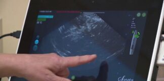 Breakthrough fibroid treatment offers hope for women station icon