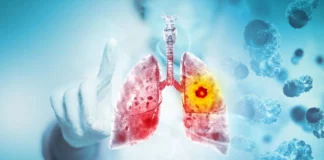 Breakthrough lung cancer treatment supercharges immune cells with mitochondria Breakthrough lung cancer treatment supercharges immune cells with mitochondria