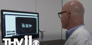 Breakthrough ovarian cancer treatment at UAMS Breakthrough ovarian cancer treatment at UAMS