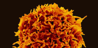 Mouse Study Breakthrough May Boost Cancer Treatment Mouse Study Breakthrough May Boost Cancer Treatment