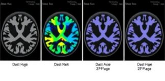 Multimodal Dataset Advances Precision Oncology in Head, Neck Multimodal Dataset Advances Precision Oncology in Head, Neck