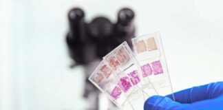 2025 Advances in Personalized Breast Cancer Treatment 2025 Advances in Personalized Breast Cancer Treatment