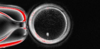 Breakthrough as human eggs made from skin cells %%page%% %%sep%% %%sitename%% Breakthrough as human eggs made from skin cells %%page%% %%sep%% %%sitename%%