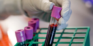 Breakthrough Drug Targets Aggressive Breast Cancer Breakthrough Drug Targets Aggressive Breast Cancer