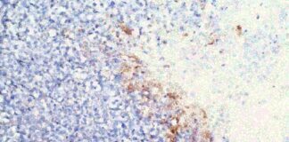 Enlighten Me: ChristianaCare Gene Editing Institute delivers lung cancer treatment breakthrough Enlighten Me: ChristianaCare Gene Editing Institute delivers lung cancer treatment breakthrough