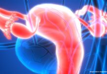 FDA Grants Breakthrough Therapy Designation to Sofetabart Mipitecan in PROC Maveropepimut-S with pembrolizumab and low-dose cyclophosphamide yielded a 40% ORR and 90% DCR in platinum-sensitive high-grade endometrial cancer.