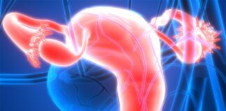 FDA Grants Breakthrough Therapy Designation to Sofetabart Mipitecan in PROC Maveropepimut-S with pembrolizumab and low-dose cyclophosphamide yielded a 40% ORR and 90% DCR in platinum-sensitive high-grade endometrial cancer.