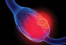 FDA OKs Breakthrough Status for Sofetabart Mipitecan for Some Gynecologic Cancers Image of man.